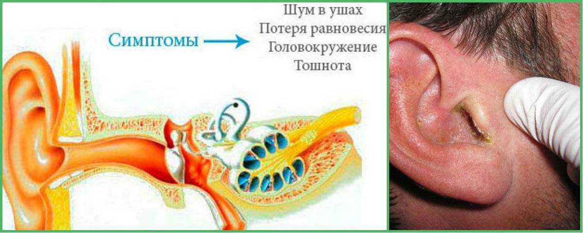 Сонник чистить уши к чему снится чистить уши во сне?